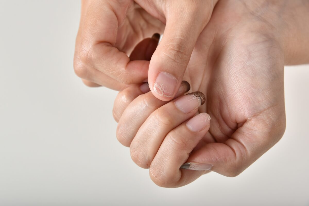 Nails fungal and bacteria infection from dirty manicure salon tools, Hand gel polish flaking and chipping, Fingernails brittle problems.