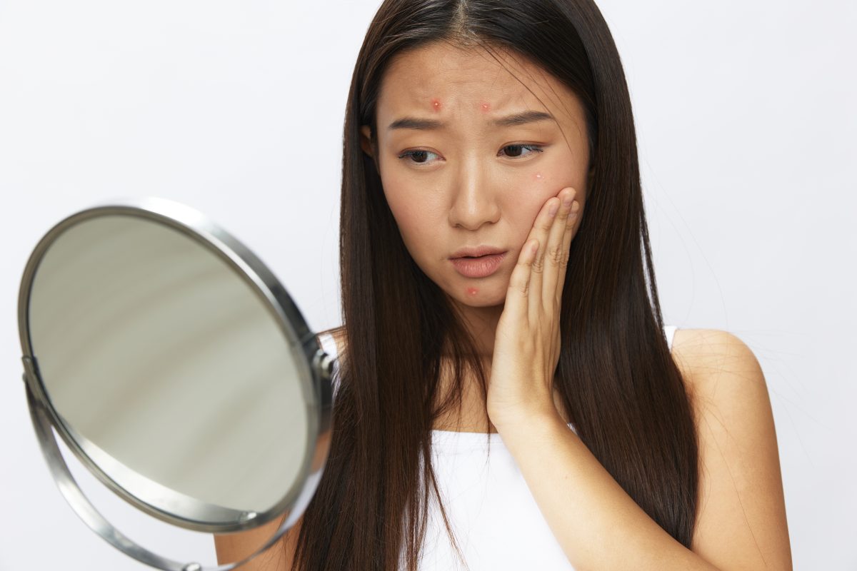 Acne Care.. Asian woman with mirror in hand facial skin problems, acne and inflammation, red rash and allergies, chicken pox, sadness from rashes. Facial skin care concept for diseases and nerves. High quality photo