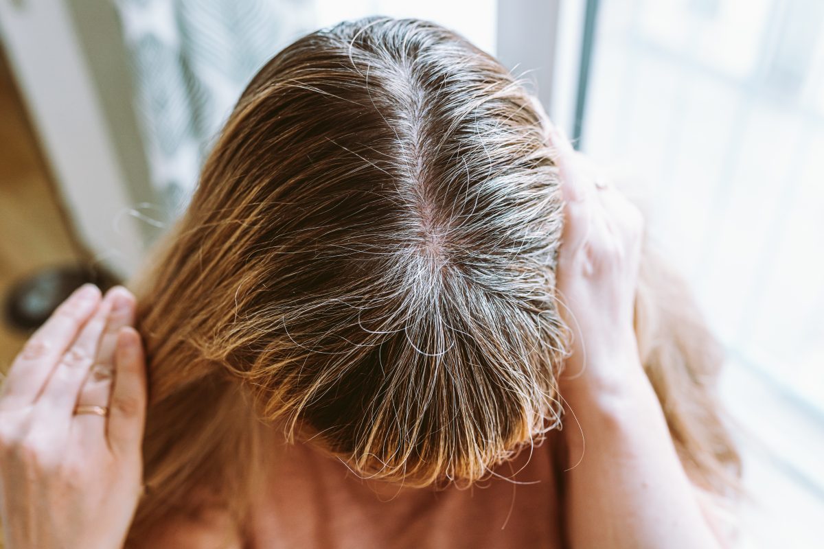 Woman showing visible hair roots close-up, highlighting scalp and natural hair growth for hair care and analysis purposes. Heat Damage Recovery